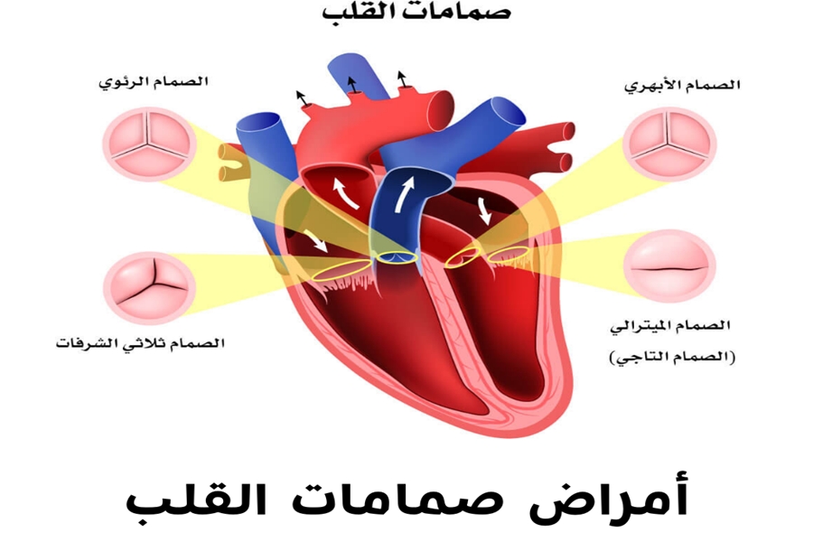 امراض صمام القلب .. اكتشف الأسباب وخيارات العلاج