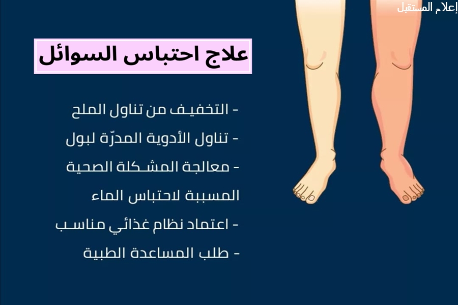 احتباس الماء في الجسم اسبابه وعلاجه بـ 8 طرق